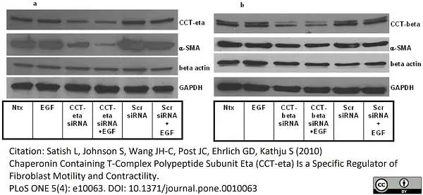 Anti CCT Beta Antibody, clone PK/8/4/4i/2F (PrecisionAb Monoclonal Antibody) gallery image 7