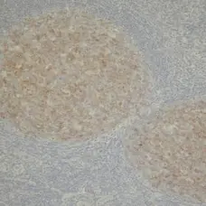 Anti Human CD10 Antibody, clone 56C6 gallery image 1