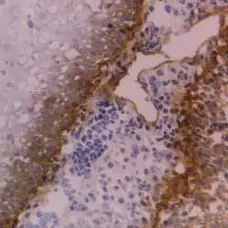 Anti Human CD104 Antibody, clone 450-9D gallery image 1