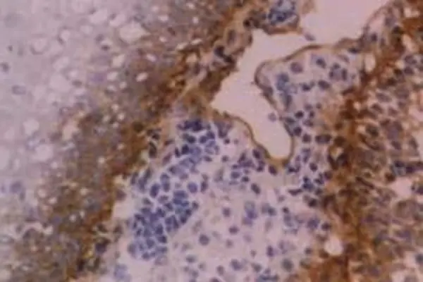 Anti Human CD104 Antibody, clone 450-9D gallery image 3