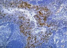 Anti Human CD115/CSF1R Antibody, clone FER216 gallery image 2