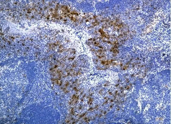 Anti Human CD115/CSF1R Antibody, clone FER216 gallery image 2