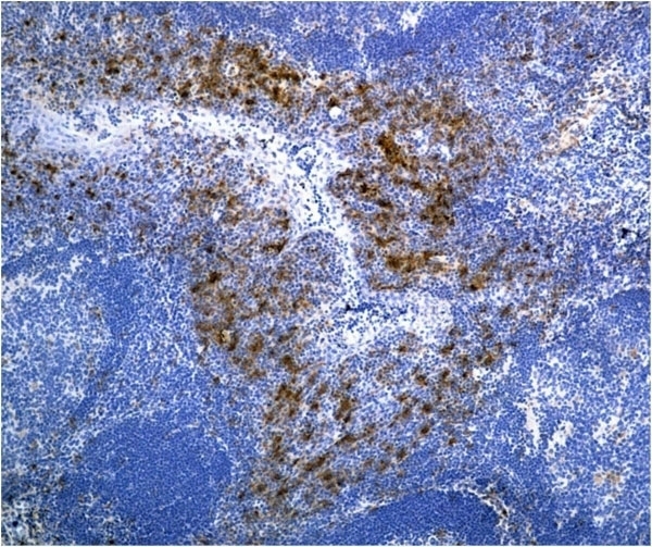 Anti Human CD115/CSF1R Antibody, clone FER216 thumbnail image 2