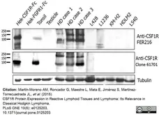 Anti Human CD115/CSF1R Antibody, clone FER216 gallery image 4