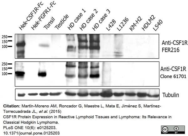 Anti Human CD115/CSF1R Antibody, clone FER216 thumbnail image 4