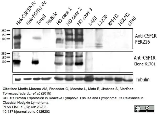 Anti Human CD115/CSF1R Antibody, clone FER216 gallery image 4