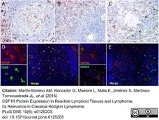 Anti Human CD115/CSF1R Antibody, clone FER216 gallery image 6