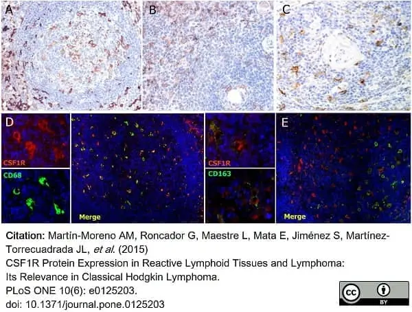 Anti Human CD115/CSF1R Antibody, clone FER216 gallery image 6