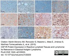 Anti Human CD115/CSF1R Antibody, clone FER216 gallery image 7