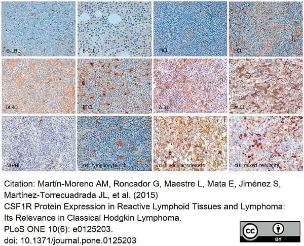 Anti Human CD115/CSF1R Antibody, clone FER216 gallery image 7