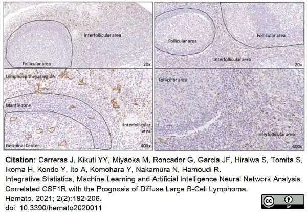 Anti Human CD115/CSF1R Antibody, clone FER216 gallery image 8