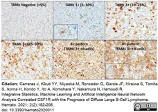Anti Human CD115/CSF1R Antibody, clone FER216 gallery image 9