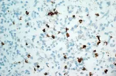 Anti Human CD11b Antibody, clone ICRF44 gallery image 4