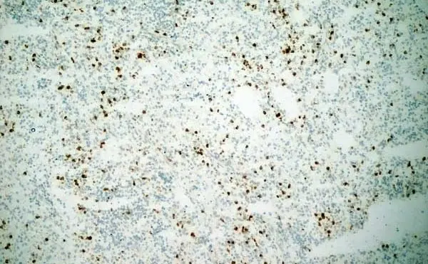 Anti Human CD11b Antibody, clone ICRF44 gallery image 5