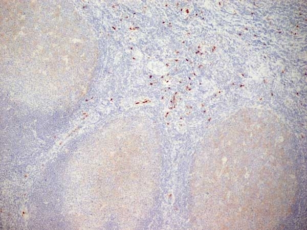 Anti Human CD11b Antibody, clone ICRF44 gallery image 8