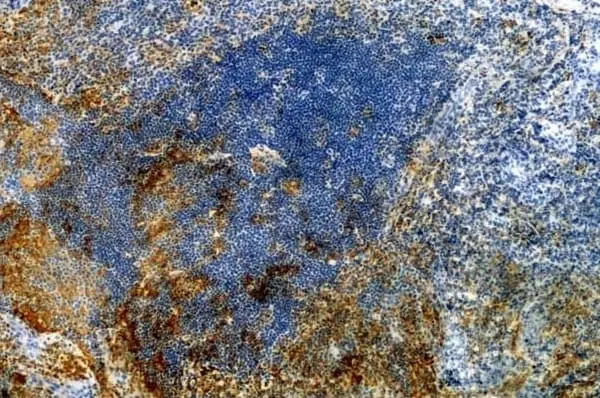Anti Human CD11c Antibody, clone BU15 gallery image 4