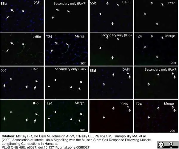 Anti Human CD126/Il-6R Antibody, clone B-R6 gallery image 2