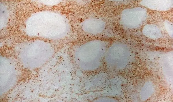 Anti Human CD13 Antibody, clone WM15 | Bio-Rad