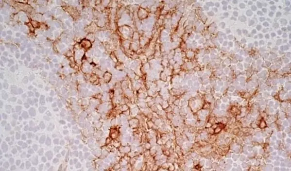 SIVA／CD13枚 Anti Human CD13 Antibody, clone WM15 | Bio-Rad