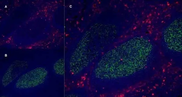 SIVA／CD13枚 Anti Human CD13 Antibody, clone WM15 | Bio-Rad