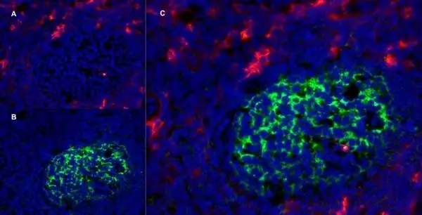 Anti Human CD13 Antibody, clone WM15 | Bio-Rad