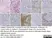 Anti Human CD138 Antibody, clone B-A38 thumbnail image 11