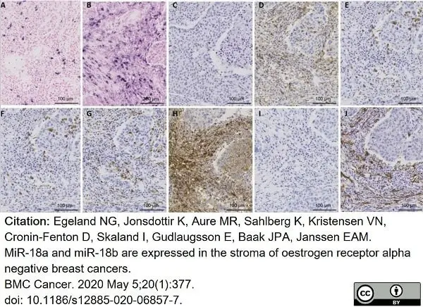 Anti Human CD138 Antibody, clone B-A38 gallery image 11