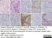 Anti Human CD138 Antibody, clone B-A38 thumbnail image 12