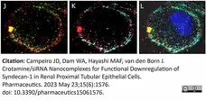 Anti Human CD138 Antibody, clone B-A38 gallery image 14