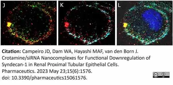Anti Human CD138 Antibody, clone B-A38 gallery image 14
