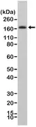 Anti CD140b Antibody, clone RM303 thumbnail image 1