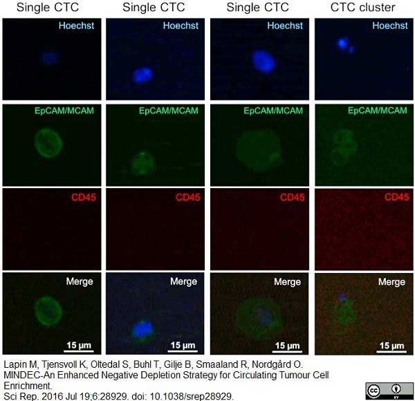 Anti Human CD146 Antibody, clone OJ79c gallery image 10