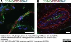 Anti Human CD146 Antibody, clone OJ79c gallery image 12