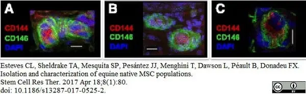 Anti Human CD146 Antibody, clone OJ79c gallery image 15