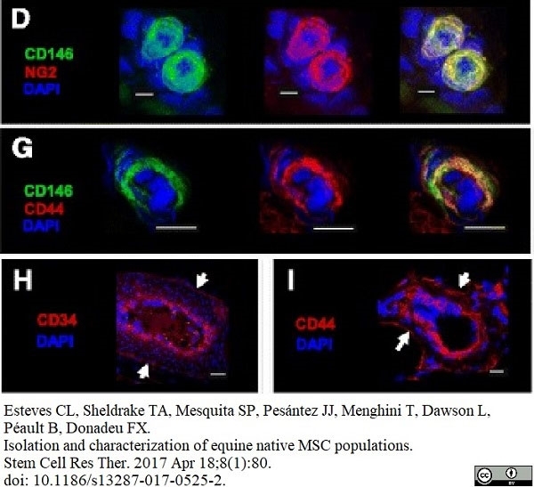 Anti Human CD146 Antibody, clone OJ79c gallery image 16