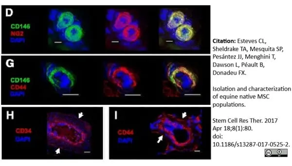 Anti Human CD146 Antibody, clone OJ79c gallery image 16