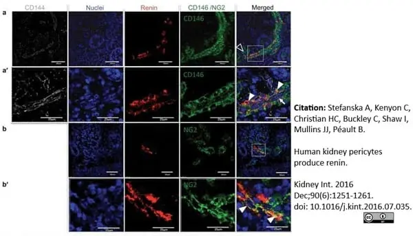 Anti Human CD146 Antibody, clone OJ79c gallery image 7