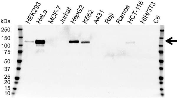 Anti CD146 Antibody, clone OTI2G10 (PrecisionAb Monoclonal Antibody) gallery image 1
