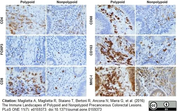 Anti Human CD163 Antibody, clone EDHu-1 gallery image 12