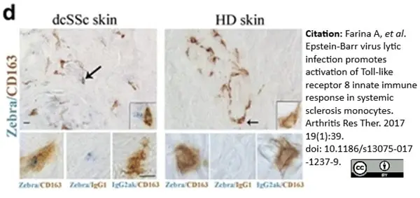 Anti Human CD163 Antibody, clone EDHu-1 gallery image 13