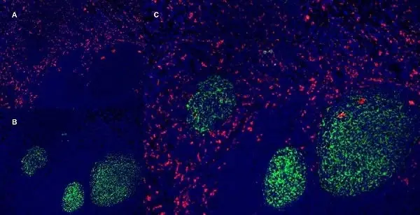 Anti Human CD163 Antibody, clone EDHu-1 gallery image 14