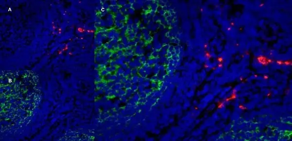 Anti Human CD163 Antibody, clone EDHu-1 gallery image 16