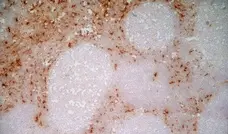 Anti Human CD163 Antibody, clone EDHu-1 gallery image 18