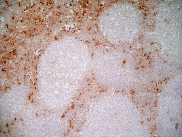 Anti Human CD163 Antibody, clone EDHu-1 gallery image 17