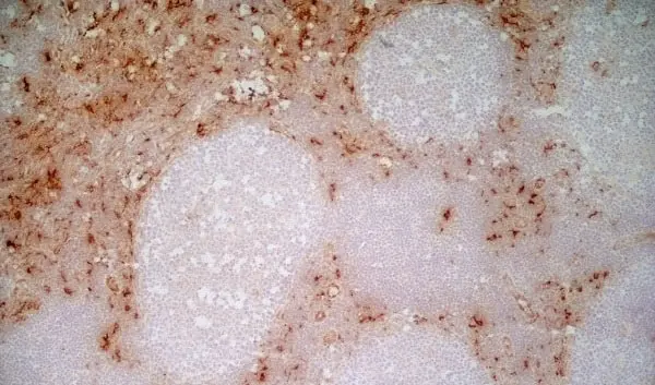 Anti Human CD163 Antibody, clone EDHu-1 gallery image 18