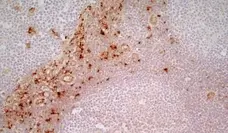 Anti Human CD163 Antibody, clone EDHu-1 gallery image 19