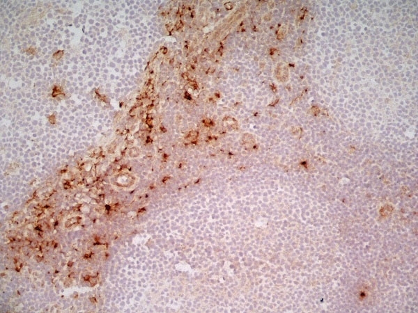 Anti Human CD163 Antibody, clone EDHu-1 gallery image 19