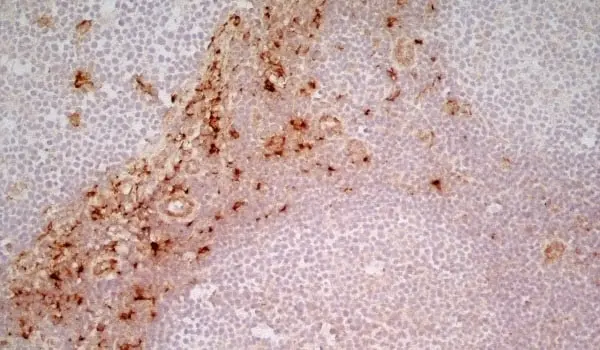 Anti Human CD163 Antibody, clone EDHu-1 gallery image 19