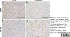 Anti Human CD163 Antibody, clone EDHu-1 gallery image 22