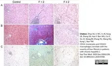 Anti Human CD163 Antibody, clone EDHu-1 gallery image 23
